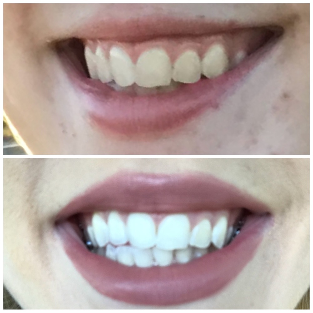 Whitening Toothpaste ✨